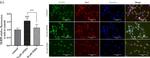 Mouse IgG (H+L) Highly Cross-Adsorbed Secondary Antibody in Immunocytochemistry (ICC/IF)