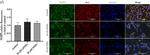 Mouse IgG (H+L) Highly Cross-Adsorbed Secondary Antibody in Immunocytochemistry (ICC/IF)