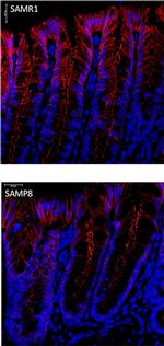 Rabbit IgG (H+L) Highly Cross-Adsorbed Secondary Antibody in Immunocytochemistry (ICC/IF)