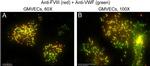 Rabbit IgG (H+L) Cross-Adsorbed Secondary Antibody in Immunocytochemistry (ICC/IF)