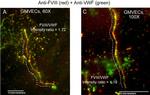 Rabbit IgG (H+L) Cross-Adsorbed Secondary Antibody in Immunocytochemistry (ICC/IF)