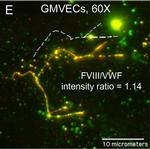 Rabbit IgG (H+L) Cross-Adsorbed Secondary Antibody in Immunocytochemistry (ICC/IF)