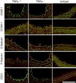 CD106 (VCAM-1) Antibody in Immunohistochemistry (Paraffin) (IHC (P))