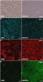 CRB2 Antibody in Immunocytochemistry (ICC/IF)