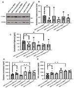 alpha Synuclein Antibody in Western Blot (WB)