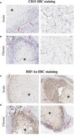 CD31 Antibody in Immunohistochemistry (IHC)