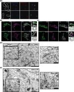 Golgin-97 Antibody in Immunocytochemistry (ICC/IF)