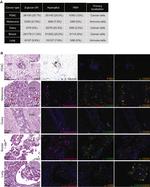 CD45 Antibody in Immunohistochemistry (IHC)