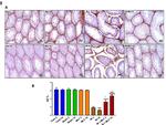 PCNA Antibody in Immunohistochemistry (IHC)