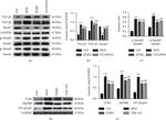 TLR4 Antibody in Western Blot (WB)