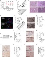 HNF4A Antibody in Immunohistochemistry (IHC)