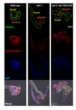 O-linked N-acetylglucosamine (O-GlcNAc) Antibody in Immunohistochemistry (IHC)