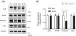 SERCA2 ATPase Antibody in Western Blot (WB)