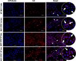 P-Glycoprotein Antibody in Immunocytochemistry (ICC/IF)