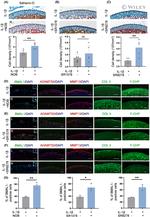 MMP13 Antibody in Immunocytochemistry (ICC/IF)