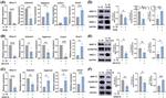 MMP13 Antibody in Western Blot (WB)