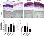 MMP13 Antibody in Immunohistochemistry (IHC)