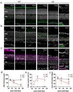 PDE6B Antibody in Immunohistochemistry (IHC)