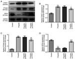 CHAC1 Antibody in Western Blot (WB)