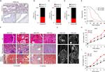 PIK3C2G Antibody in Immunohistochemistry (IHC)