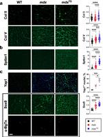 SPTBN1 Antibody in Immunohistochemistry (Frozen) (IHC (F))