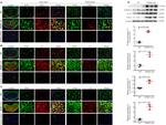 S100A10 Antibody in Western Blot, Immunohistochemistry (WB, IHC)