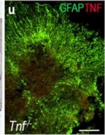 Rabbit IgG (H+L) Highly Cross-Adsorbed Secondary Antibody in Immunohistochemistry (IHC)