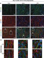 Chicken IgY (H+L) Secondary Antibody in Immunohistochemistry (Paraffin) (IHC (P))