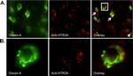 Goat IgG (H+L) Cross-Adsorbed Secondary Antibody in Immunohistochemistry (IHC)