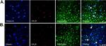 Goat IgG (H+L) Cross-Adsorbed Secondary Antibody in Immunohistochemistry (IHC)