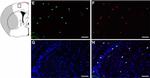 Goat IgG (H+L) Cross-Adsorbed Secondary Antibody in Immunohistochemistry (Paraffin) (IHC (P))