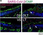 Goat IgG (H+L) Cross-Adsorbed Secondary Antibody in Immunohistochemistry (IHC)