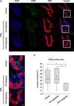 Mouse IgG (H+L) Highly Cross-Adsorbed Secondary Antibody in Immunohistochemistry (Paraffin) (IHC (P))