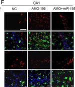 Mouse IgG (H+L) Highly Cross-Adsorbed Secondary Antibody in Immunocytochemistry (ICC/IF)