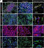 Mouse IgG (H+L) Highly Cross-Adsorbed Secondary Antibody in Immunocytochemistry (ICC/IF)