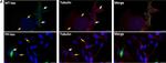 Mouse IgG (H+L) Highly Cross-Adsorbed Secondary Antibody in Immunocytochemistry (ICC/IF)