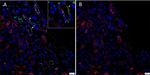 Rabbit IgG (H+L) Highly Cross-Adsorbed Secondary Antibody in Immunohistochemistry (IHC)