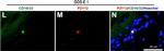 Rabbit IgG (H+L) Highly Cross-Adsorbed Secondary Antibody in Immunohistochemistry (Frozen) (IHC (F))