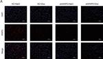 Rabbit IgG (H+L) Highly Cross-Adsorbed Secondary Antibody in Immunohistochemistry (IHC)