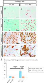 Ki-67 Antibody in Immunohistochemistry (IHC)