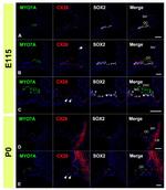 Connexin 26 Antibody in Immunohistochemistry (IHC)