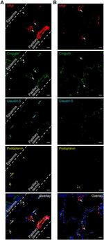 Claudin 5 Antibody in Immunohistochemistry (Frozen) (IHC (F))