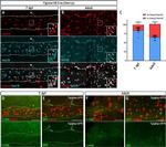 HuC/HuD Antibody in Immunohistochemistry (IHC)