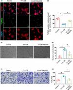 Cardiac Troponin I Antibody in Immunohistochemistry (Paraffin) (IHC (P))