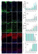 Collagen II Antibody in Immunohistochemistry (IHC)