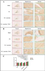 Collagen II Antibody in Immunohistochemistry (IHC)