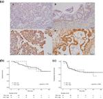 PD-L1 Antibody in Immunohistochemistry (IHC)