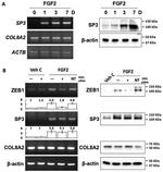 ZEB1 Antibody in Western Blot (WB)