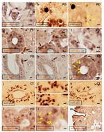 IYD Antibody in Immunohistochemistry (IHC)