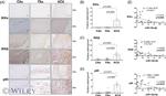 NFkB p65 Antibody in Immunohistochemistry (Paraffin) (IHC (P))